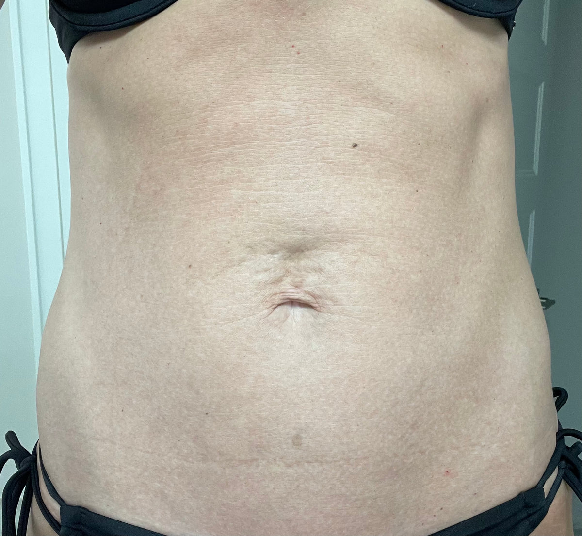 Before image