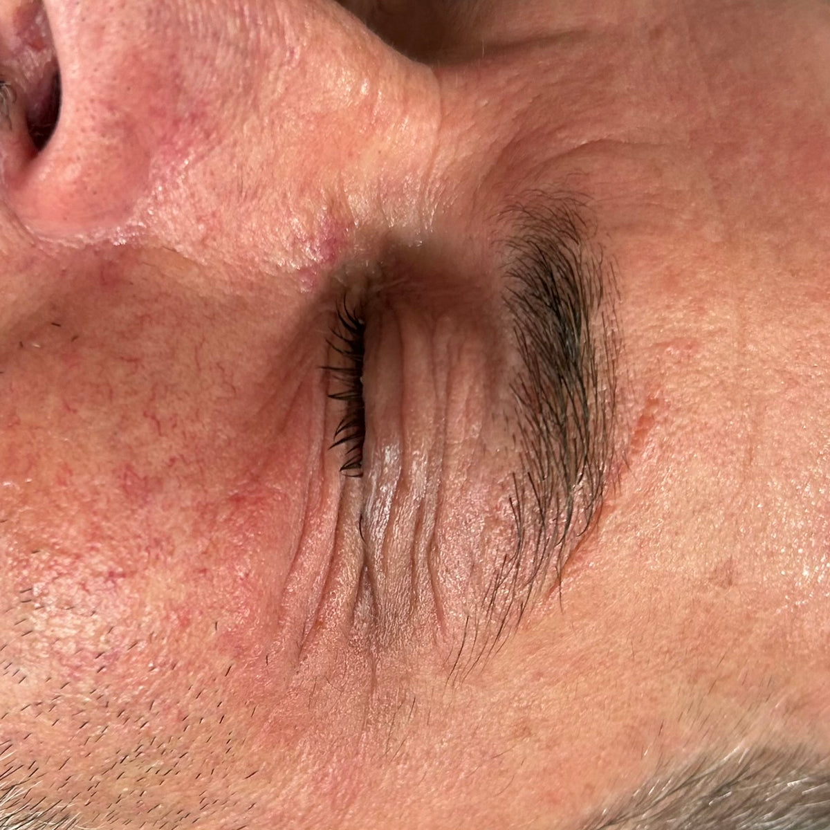 After image