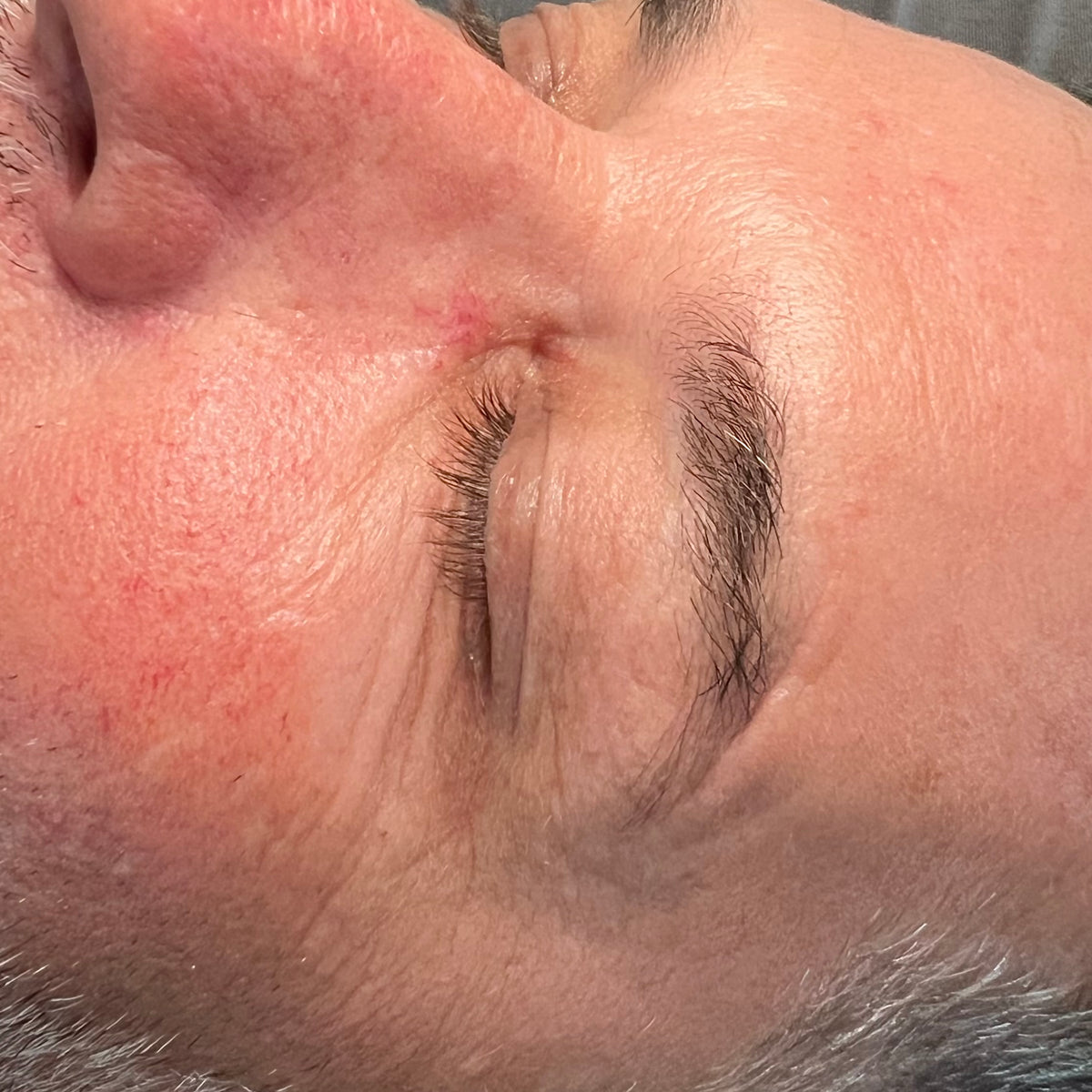 Before image